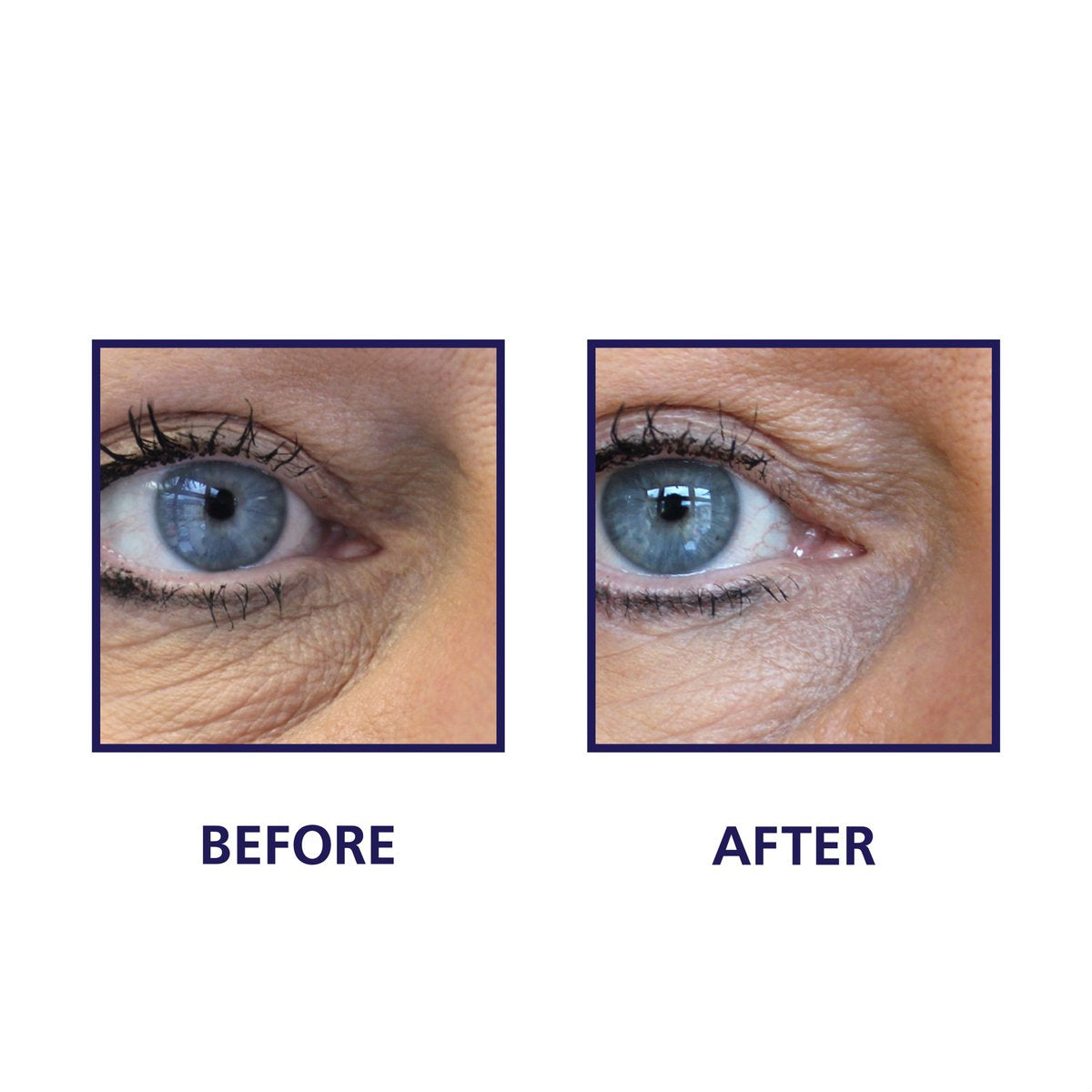 iS Clinical - Youth Eye Complex