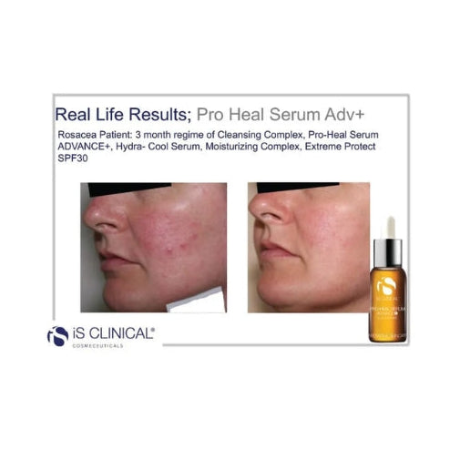 iS Clinical - Pro-Heal Serum Advance +