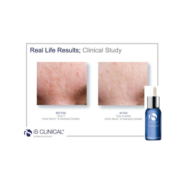 iS Clinical - Active Serum